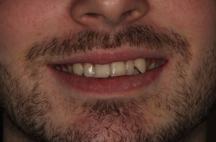 Before - Cheadle Hulme Dental