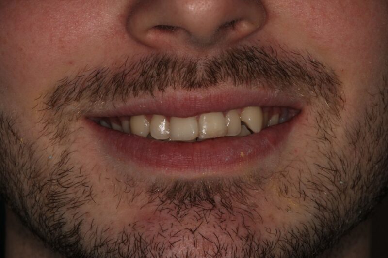 Before - Cheadle Hulme Dental