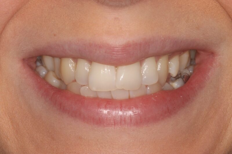 Before - Cheadle Hulme Dental