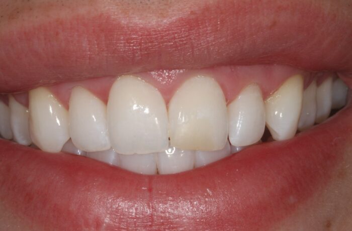 Before - Cheadle Hulme Dental