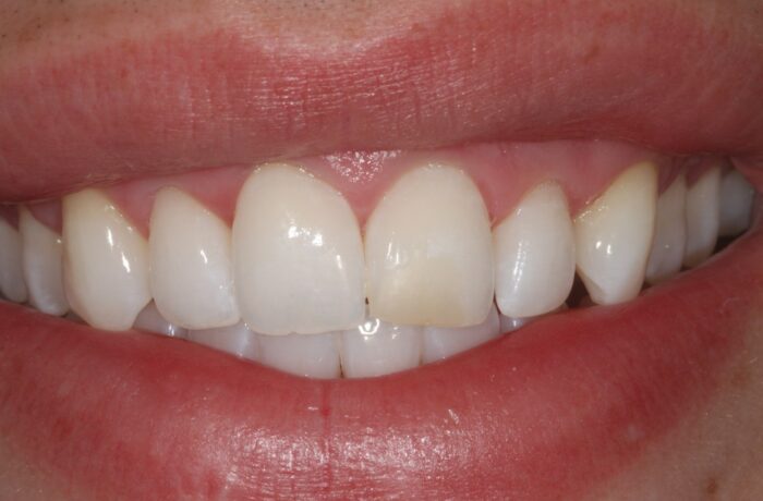 Before - Cheadle Hulme Dental