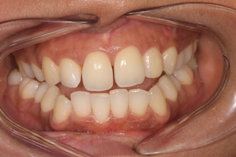 Before - Cheadle Hulme Dental