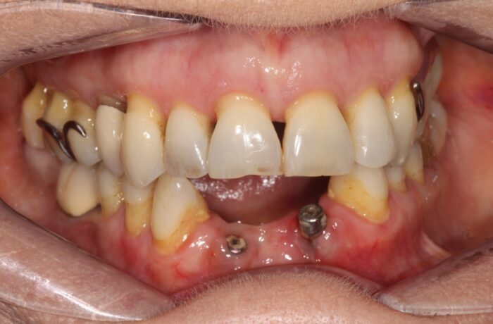 Before - Cheadle Hulme Dental