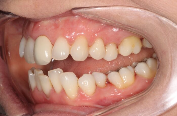 Before - Cheadle Hulme Dental