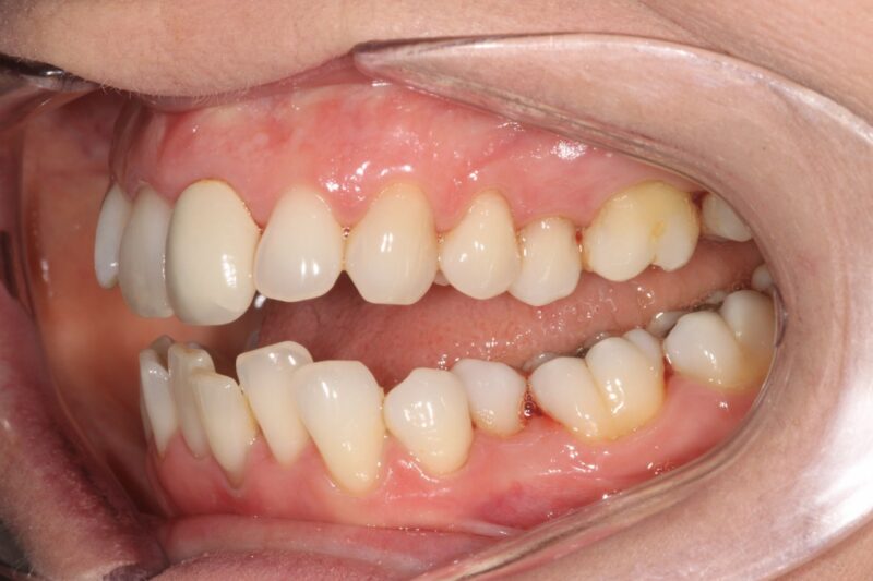 Before - Cheadle Hulme Dental