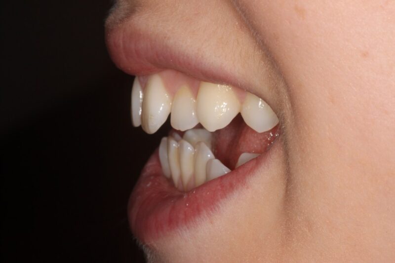 Before - Cheadle Hulme Dental