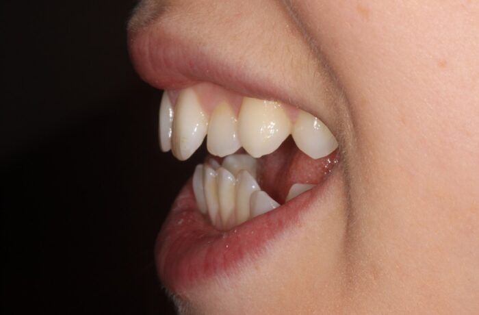 Before - Cheadle Hulme Dental