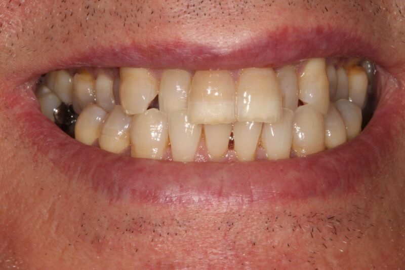 Before - Cheadle Hulme Dental