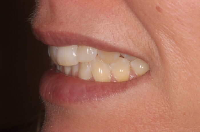 Before - Cheadle Hulme Dental