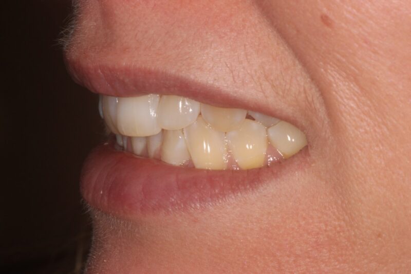 Before - Cheadle Hulme Dental