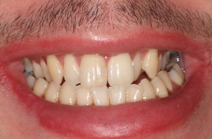 Before - Cheadle Hulme Dental