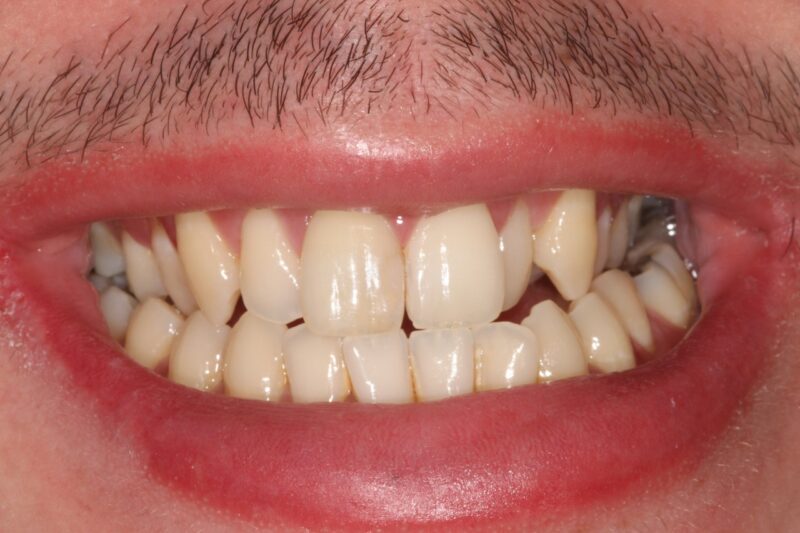 Before - Cheadle Hulme Dental