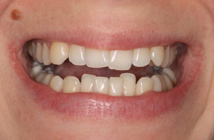 Before - Cheadle Hulme Dental