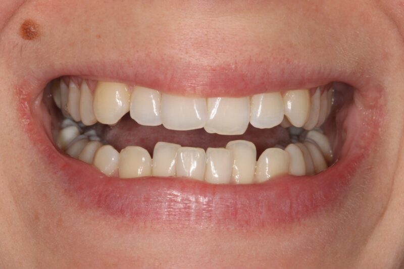 Before - Cheadle Hulme Dental