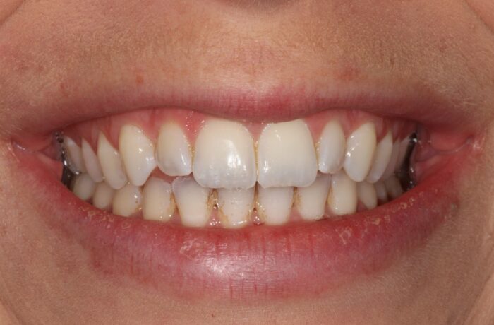 Before - Cheadle Hulme Dental