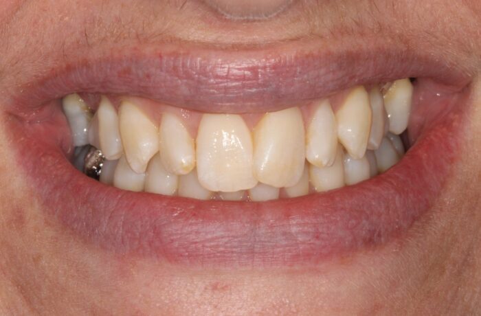 Before - Cheadle Hulme Dental