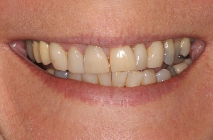 Before - Cheadle Hulme Dental