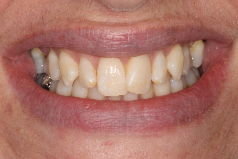 Before - Cheadle Hulme Dental