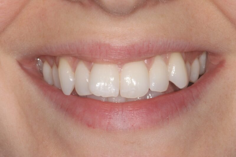 Before - Cheadle Hulme Dental