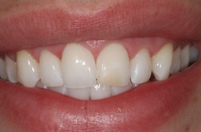 Before - Cheadle Hulme Dental