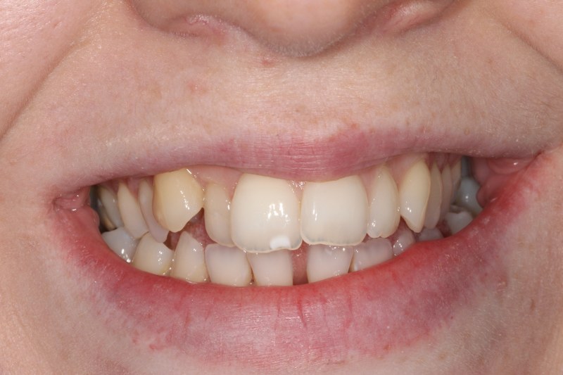 Before - Cheadle Hulme Dental