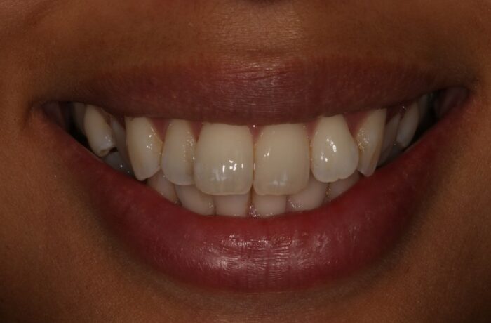 Before - Cheadle Hulme Dental
