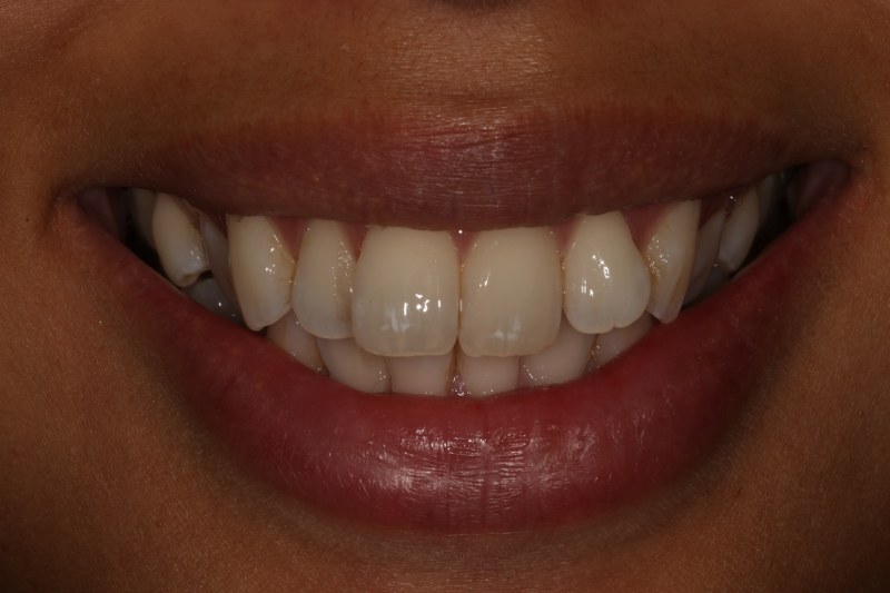 Before - Cheadle Hulme Dental