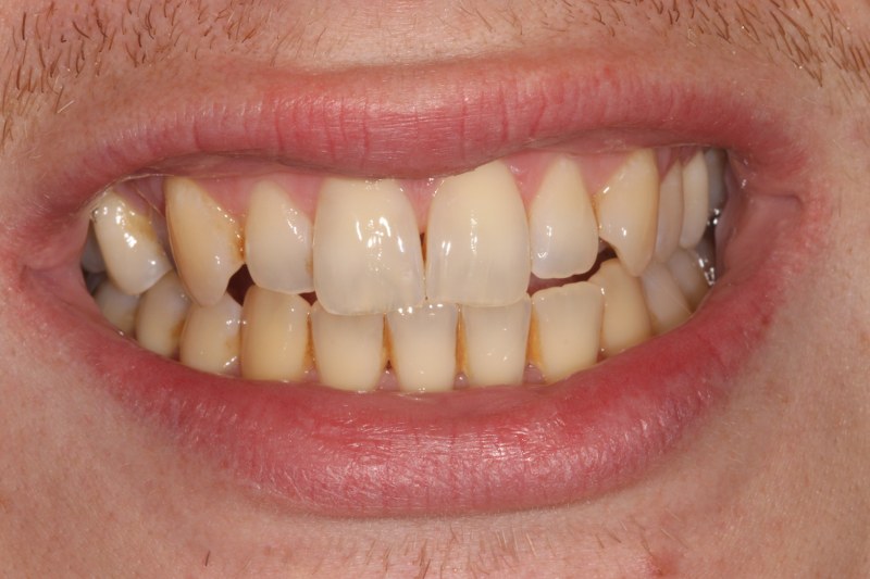 Before - Cheadle Hulme Dental