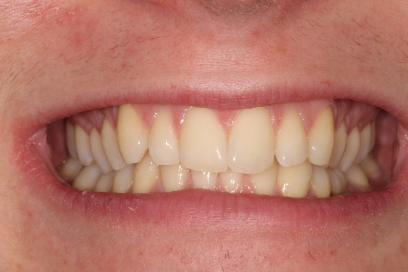 Before - Cheadle Hulme Dental