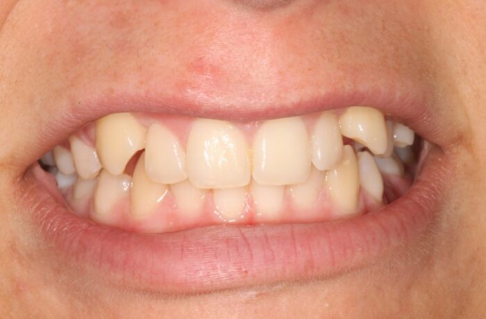 Before - Cheadle Hulme Dental