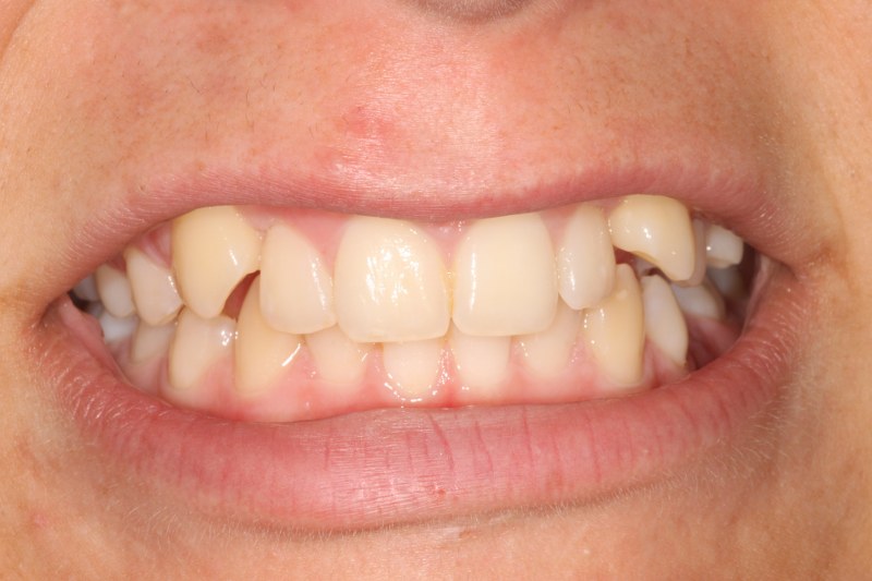 Before - Cheadle Hulme Dental