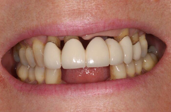 Before - Cheadle Hulme Dental