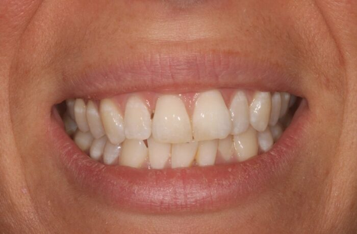 Before - Cheadle Hulme Dental