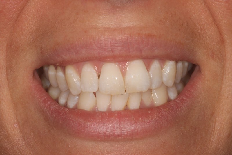 Before - Cheadle Hulme Dental