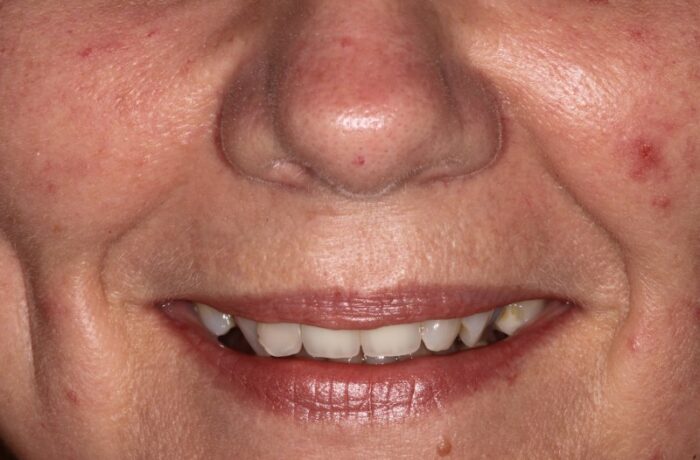 Before - Cheadle Hulme Dental