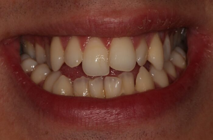 Before - Cheadle Hulme Dental