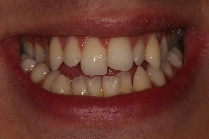 Before - Cheadle Hulme Dental