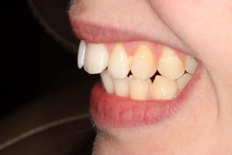 Before - Cheadle Hulme Dental