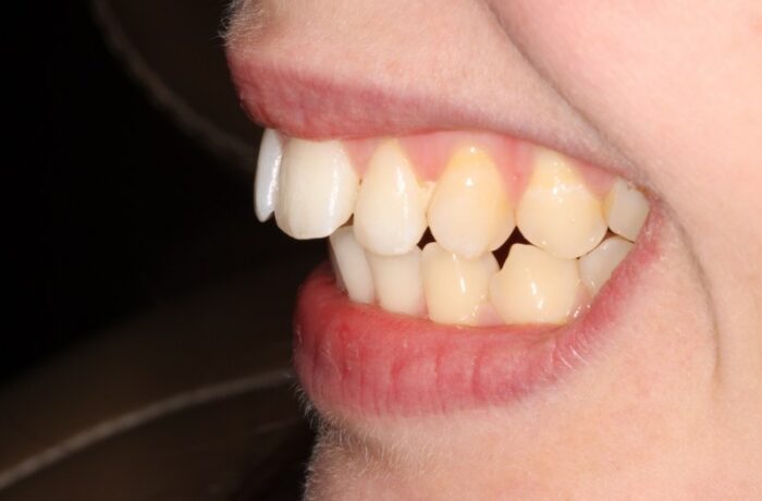 Before - Cheadle Hulme Dental