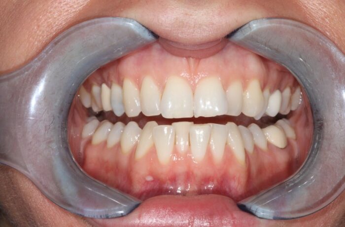 Before - Cheadle Hulme Dental