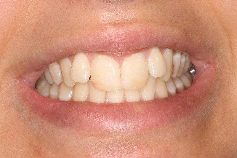 Before - Cheadle Hulme Dental