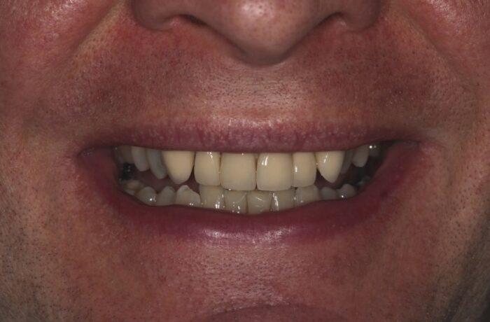 Before - Cheadle Hulme Dental