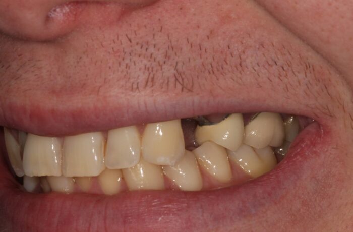 Before - Cheadle Hulme Dental