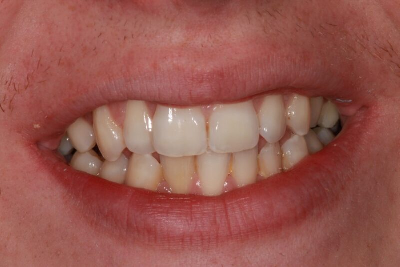 Before - Cheadle Hulme Dental