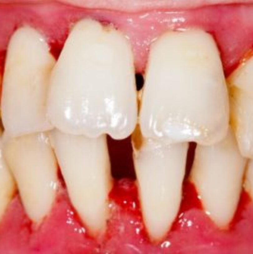 blog - Cheadle Hulme Dental