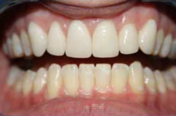 After - Cheadle Hulme Dental