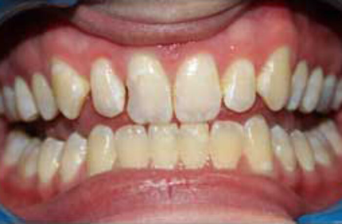 Before - Cheadle Hulme Dental