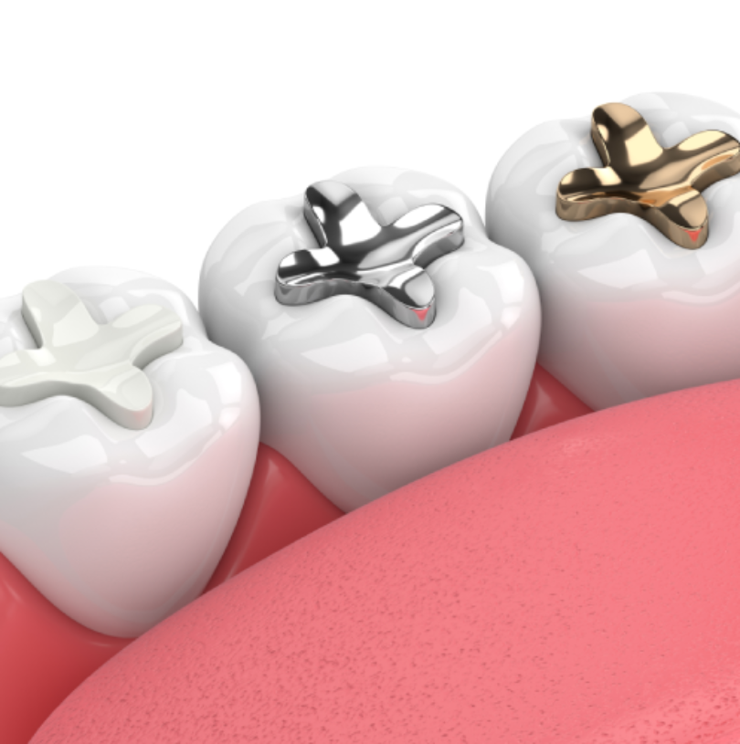 blog - Cheadle Hulme Dental