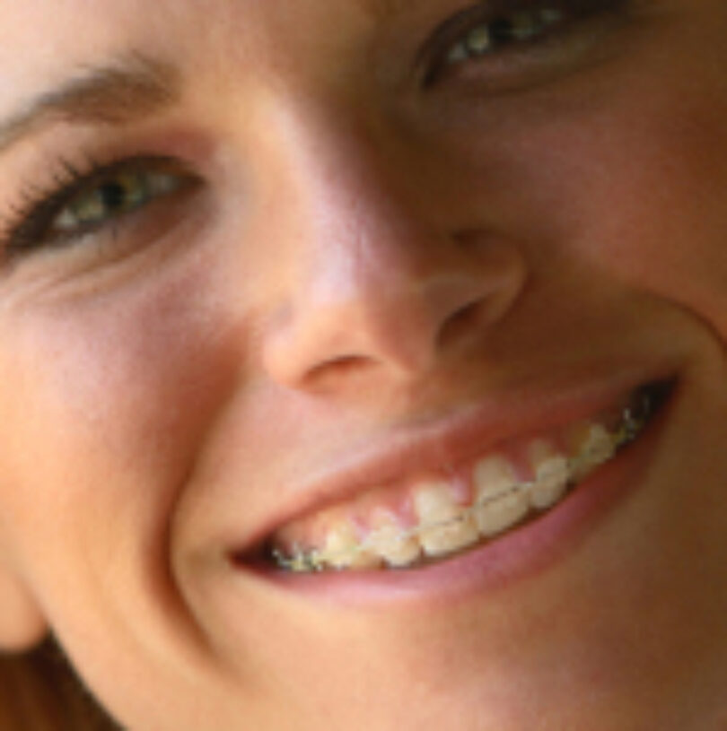 blog - Cheadle Hulme Dental