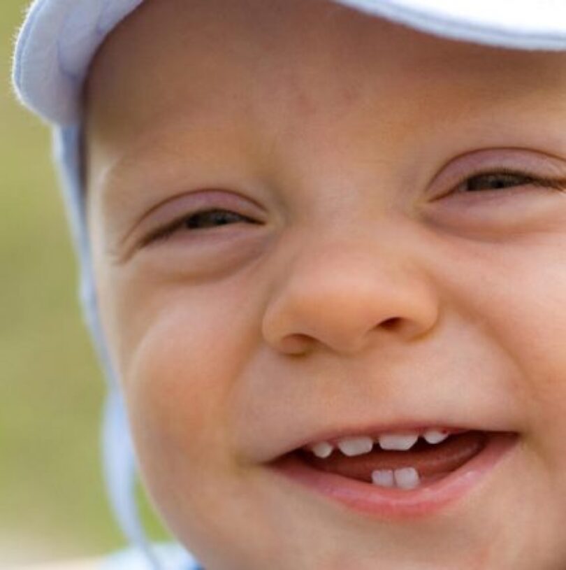 blog - Cheadle Hulme Dental